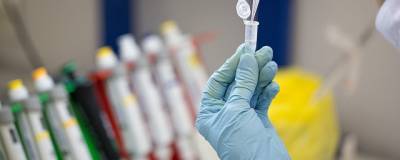 Ханс Клюге - ВОЗ: Россия успешно завершит испытания вакцины от COVID-19 - runews24.ru - Россия