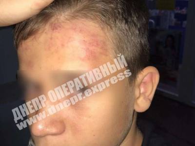 В Никополе ромы у школы избили 12-летнего мальчика - golos.ua - Днепропетровская обл. - Закарпатская обл. - Никополь