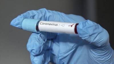 В Азербайджане выявлено 92 новых случая инфицирования коронавирусом - aze.az - Азербайджан