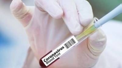 В Пензенской области зафиксировали более 10 тысяч случаев COVID-19 - penzainform.ru - Пензенская обл. - Пенза - Каменск