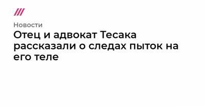 Максим Марцинкевич - Отец и адвокат Тесака рассказали о следах пыток на его теле - tvrain.ru - Челябинск