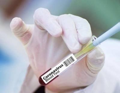 Китайская вакцина от COVID-19 может появиться в продаже к концу 2020 года - argumenti.ru - Россия - Китай - Франция