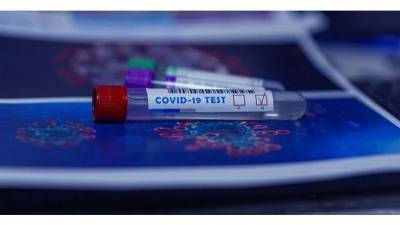 В Анталье коронавирус обнаружили у восьми россиян - piter.tv - Турция - провинция Анталья