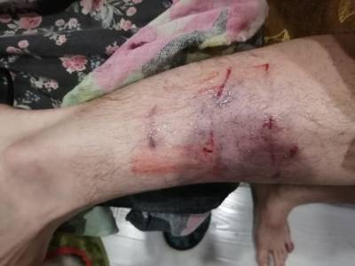 В Ухте собаки продолжают нападать на людей - bnkomi.ru