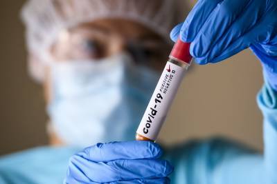 Недостаточно COVID-тестов делают лишь в двух областях – Минздрав - news.bigmir.net - Украина - Киев - Львовская обл. - Закарпатская обл.