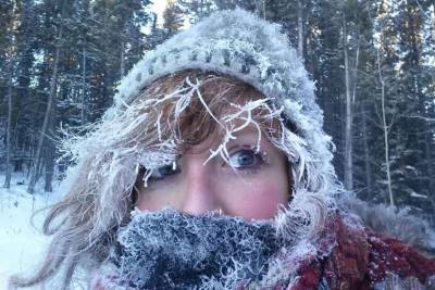 Мороз - Ошибки при обморожении назвал врач - lenta.ua