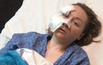 В турецком ТЦ муж порезал лицо 28-летней украинке (видео) - sharij.net - Турция - Стамбул - Нападение
