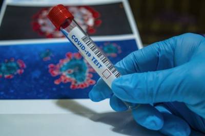 ВОЗ: за неделю число случаев коронавируса в мире возросло на 93 тысячи - aif.ru - США - Англия - Бразилия