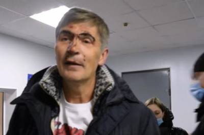 В Николаеве экс-нардеп подвергся жесткому задержанию. ВИДЕО - from-ua.com