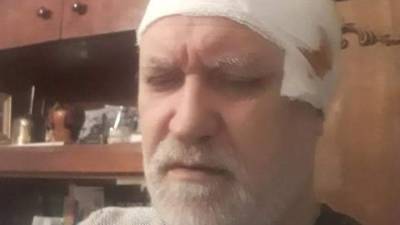 В Запорожье напали на священников УПЦ МП - news-front.info - Москва - Украина - Запорожье