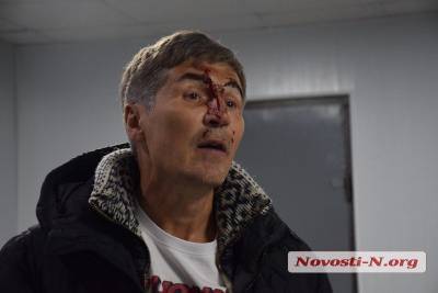 Разбитое в кровь лицо: В Николаеве экс-нардеп подрался с полицией - news.bigmir.net - Николаев