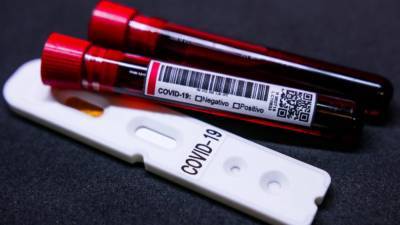 COVID-19 в Украине: выявлено более 5,5 тысяч новых случаев коронавируса за минувшие сутки - vchaspik.ua - місто Київ