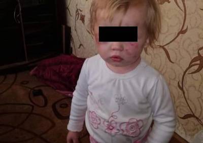 После избиения малышей в Рыбном на их мать завели уголовное дело - ya62.ru - Рязанская обл.