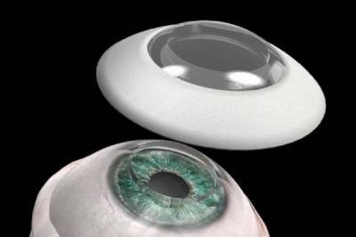 В Израиле врачи впервые успешно пересадили искусственные роговицы, вернув зрение слепому - zik.ua - Израиль