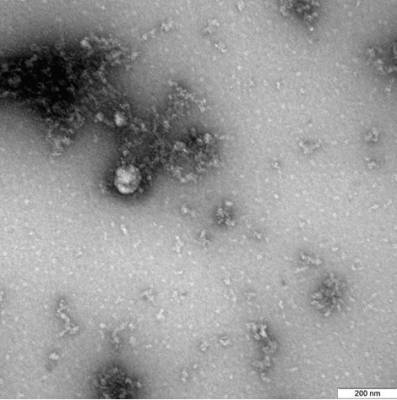 Ученые из "Вектора" показали "фотографию" британского штамма SARS-CoV-2 - nakanune.ru