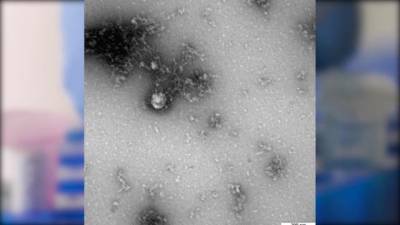 Роспотребнадзор получил первое изображение британского штамма коронавируса - delovoe.tv