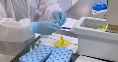 Виктор Ляшко - Украинцы, которые переболели COVID-19, не получат прививку в первой волне, – Ляшко - focus.ua