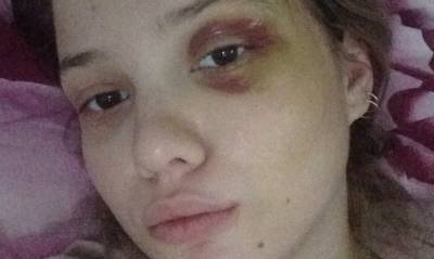 Фото: парень погибшей в Мурино девушки неоднократно ее избивал - ivbg.ru