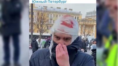 Петербурженка вычислила на незаконной акции провокатора с "разбитой головой" - newinform.com - Петербург