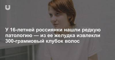У 16-летней россиянки нашли редкую патологию — из ее желудка извлекли 300-граммовый клубок волос - news.tut.by - Россия - Кировская обл.