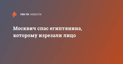 Москвич спас египтянина, которому изрезали лицо - ren.tv - Египет - Московская обл. - Москва