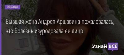 Андрей Аршавин - Алиса Казьмина - Бывшая жена Андрея Аршавина пожаловалась, что болезнь изуродовала ее лицо - skuke.net