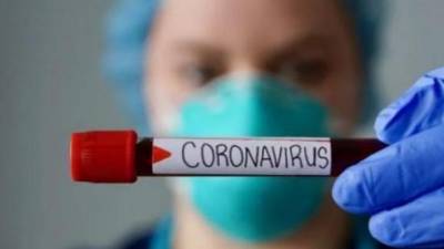 Максим Степанов - За сутки в Украине обнаружили 6911 случаев заражения коронавирусом, 228 человек умерли - ru.espreso.tv - Киев