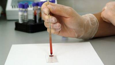 Вадим Наумов - Ученые назвали группу крови с самым сильным иммунитетом к вирусам - nation-news.ru