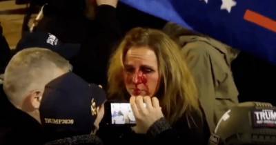 Дональд Трамп - В Вашингтоне произошли столкновения между полицией и поклонниками Трампа (видео) - focus.ua - США - Вашингтон