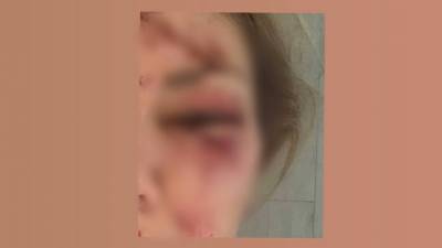 Чудом удалось выжить: аттракцион едва не забрал жизнь харьковчанки с ребенком, кадры - kharkov.politeka.net - Харьков
