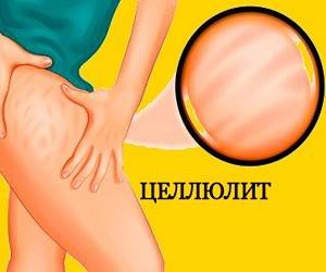 Рецепт волшебного средства, который плавит целлюлит - goodnews.ua
