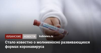 Михаил Мурашко - Стало известно о молниеносно развивающихся формах коронавируса - kubnews.ru - Россия