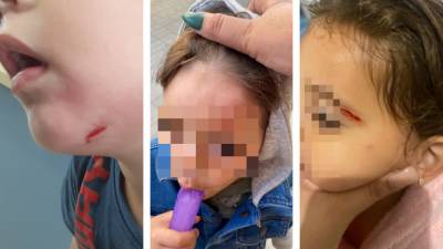 Укусы, ушибы и ссадины: 3-летний мальчик терроризирует детский сад в Ришон ле-Ционе - vesty.co.il - Израиль