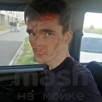 21-летний Владислав превратил свою сводную 3- летнюю сестру в кровавое месиво - vologda-poisk.ru - Ленинградская обл. - р-н Всеволожский
