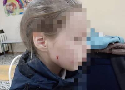 Бабушка в Уфе избила чужого ребенка за попытку покормить бездомных кошек - province.ru - Уфа