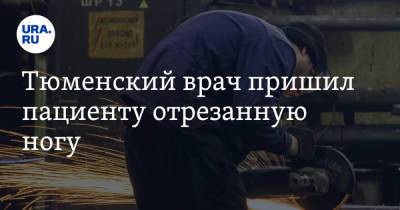 Тюменский врач пришил пациенту отрезанную ногу - ura.news - Тюменская обл.
