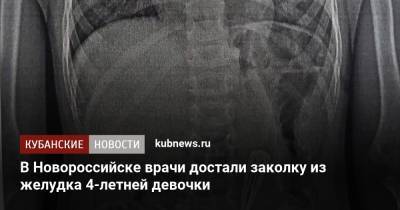 В Новороссийске врачи достали заколку из желудка 4-летней девочки - kubnews.ru - Краснодарский край - Новороссийск