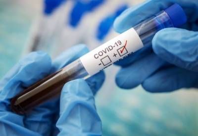 Новые антирекорды: в Украине более 23 тысяч новых случаев COVID-19 - facenews.ua - Украина - Киев - Волынская обл. - Днепропетровская обл. - Винницкая обл. - Житомирская обл. - Закарпатская обл. - Донецкая обл.