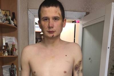 Правозащитник рассказал об избиении заключённого в архангельской колонии - arh.mk.ru - Архангельск