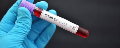 Как лечить COVID-19 дома: что делать, если заразился, но ехать в больницу необходимости нет - runews24.ru - Россия