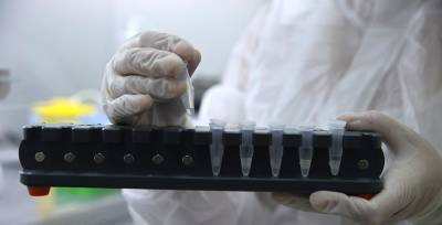 В Беларуси переходят на активное использование тестов на антиген к коронавирусу - это более дешевая и быстра альтернатива ПЦР-тестам - grodnonews.by - Белоруссия