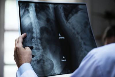 Эндокринологический научный центр рассказал как лечить остеопороз и избежать переломов - vm.ru - Россия