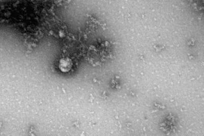 Владимир Гущин - Эксперт Центра Гамалеи оценил опасность нового штамма коронавируса AY.4.2 - vm.ru