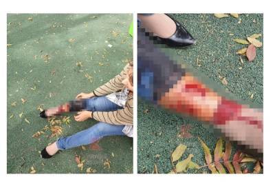 В Краснодаре женщина пострадала от нападения собак, спасая чужого ребёнка - kuban.mk.ru - Краснодар