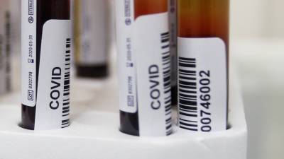 Николай Крючков - В Новосибирской области прокомментировали ситуацию с COVID-19 - russian.rt.com - Новосибирская обл. - Оренбургская обл.