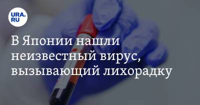 В Японии нашли неизвестный вирус, вызывающий лихорадку - ura.news - Китай - Япония - Конго