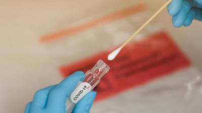 Ученые определили, почему вакцина против COVID-19 не всегда эффективна - enovosty.com - Голландия