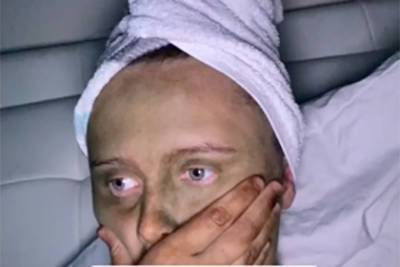 Ошибка при нанесении автозагара превратила девушку в Фиону из «Шрека» - lenta.ru - Шотландия