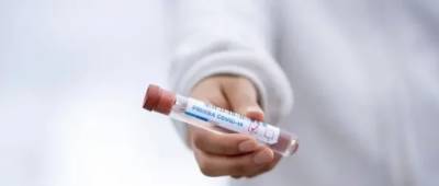 Украина стала пятой в мире по числу новых случаев COVID-19 и третьей по смертности за сутки - w-n.com.ua - Россия - США - Украина - Англия - Турция - Германия - Румыния - Мексика - Индия