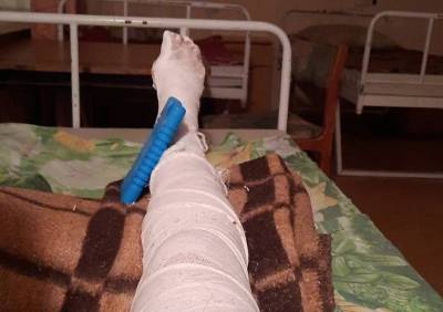 В Рязани беременная женщина сломала ногу при выходе из маршрутки - ya62.ru - Рязань